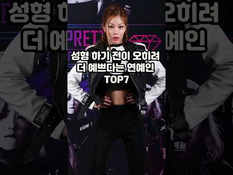 성형 전이 오히려 더 예쁘다는 연예인 TOP7