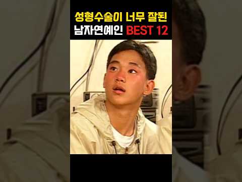 성형이 너무 잘된 남자연예인 BEST 12